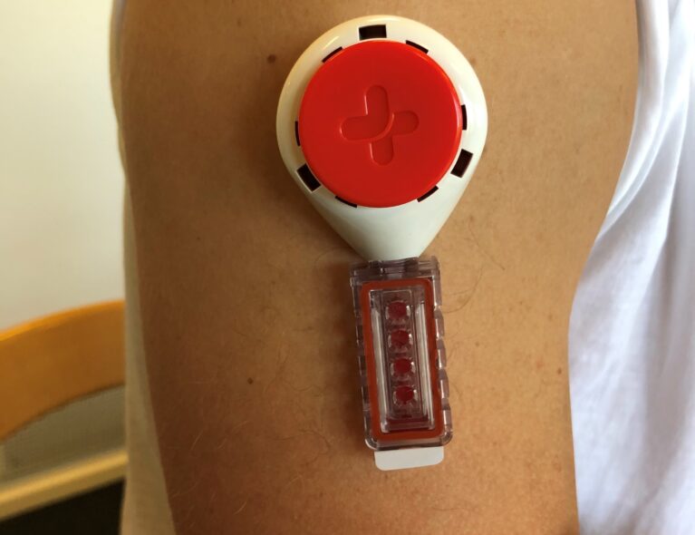 Doping: – Mindre inngripende for utøveren!